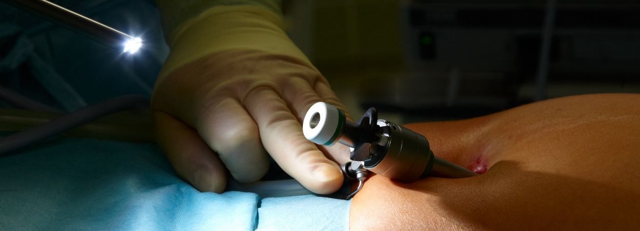 Laparoscopy image