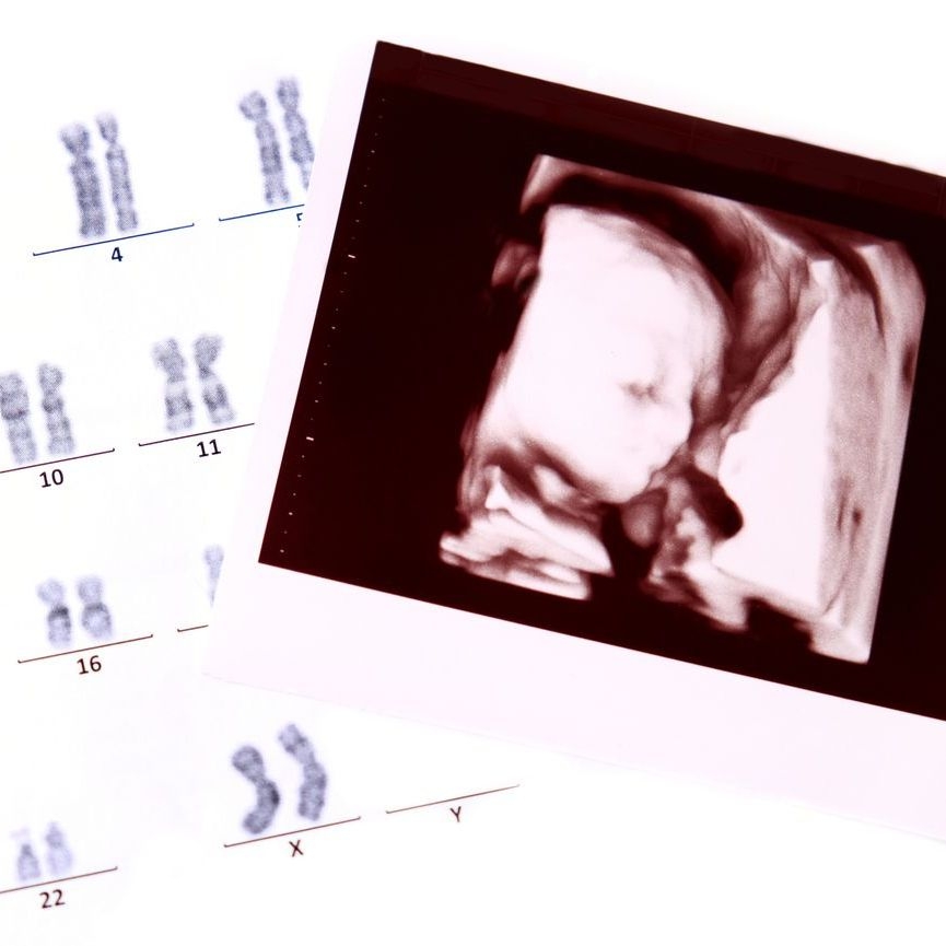 Prenatal diagnostic image