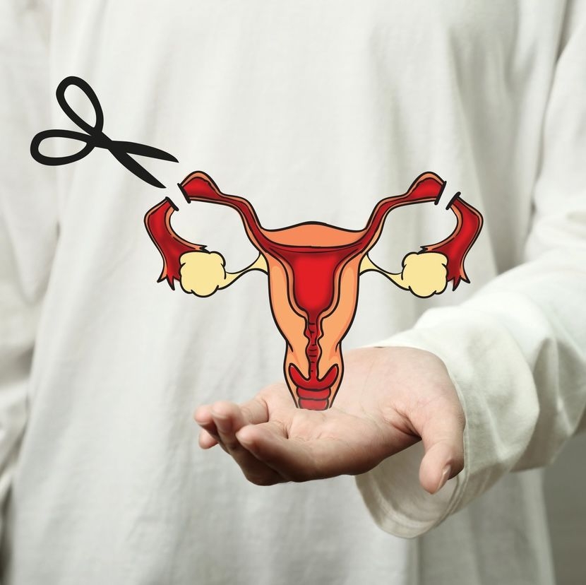 Sterilisation image